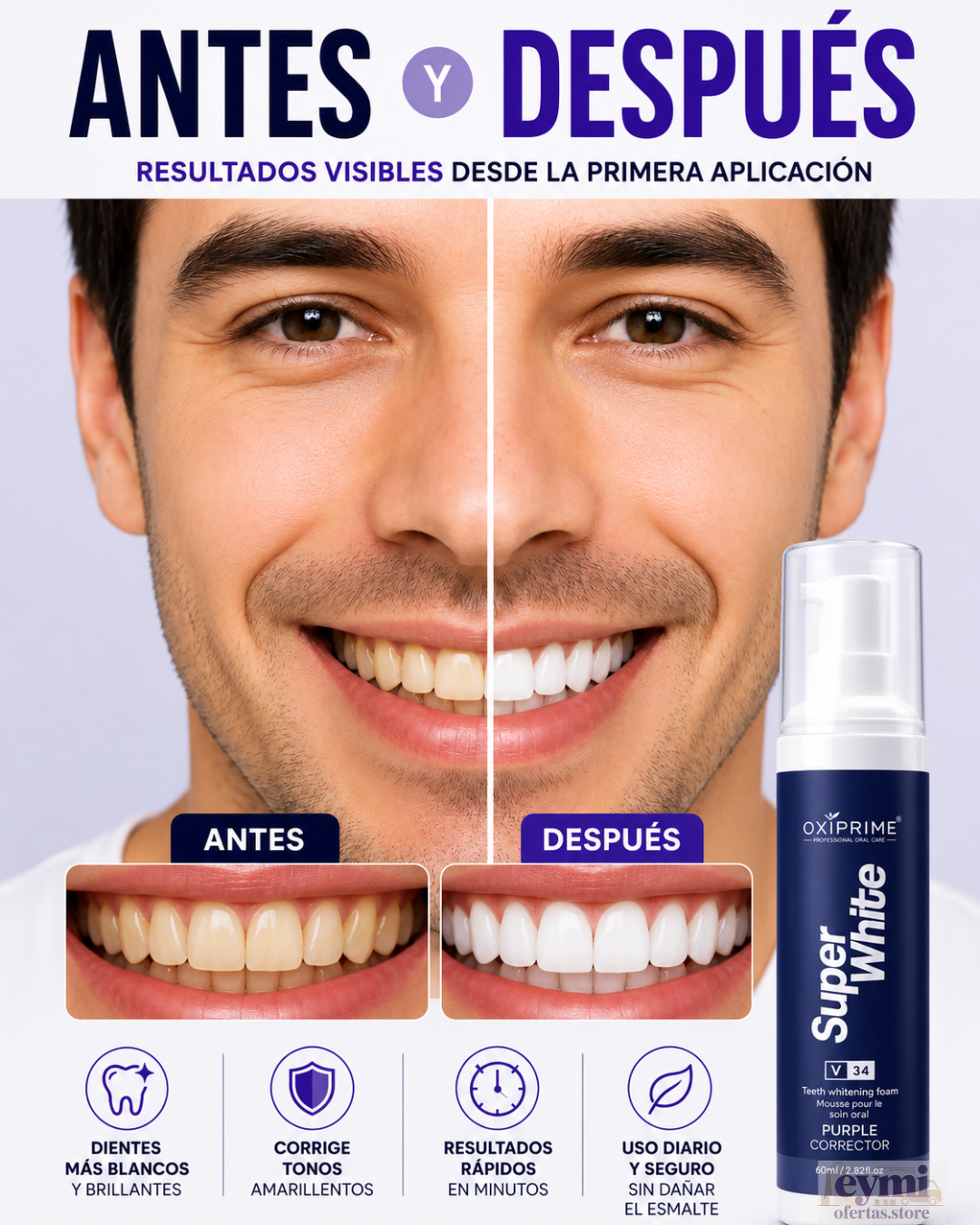 Blanqueadora Dental Oxiprime Super White 80ml